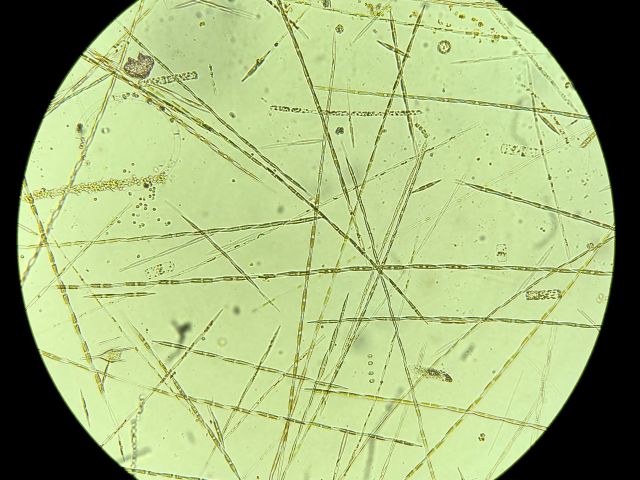 PN under the microscope